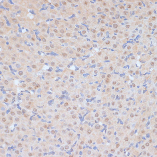 CDK9 Polyclonal Antibody (E-AB-64038)