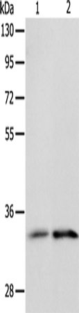 ST2 Polyclonal Antibody (E-AB-14446)