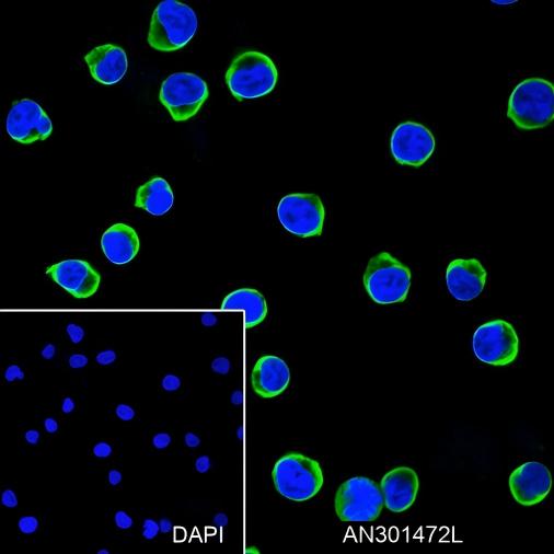 Recombinant CD25 Monoclonal Antibody (AN301472L)