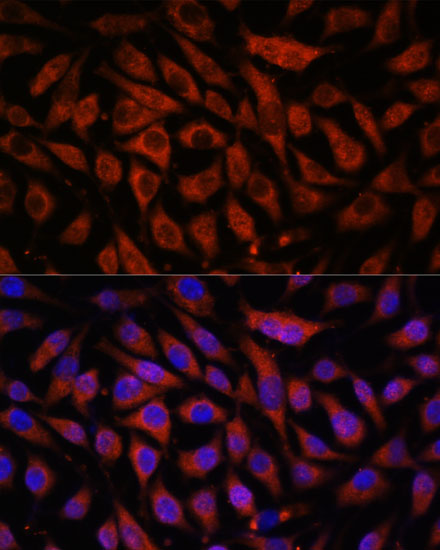 STK38L Polyclonal Antibody (E-AB-66480)