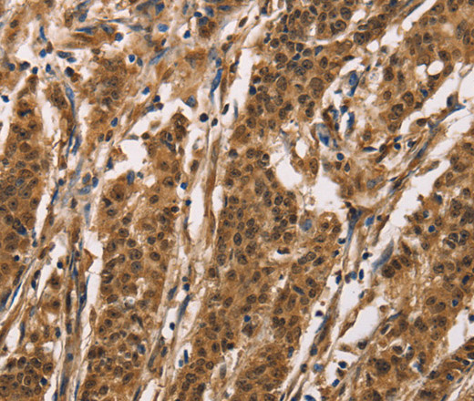 ADGRB1 Polyclonal Antibody (E-AB-16273)
