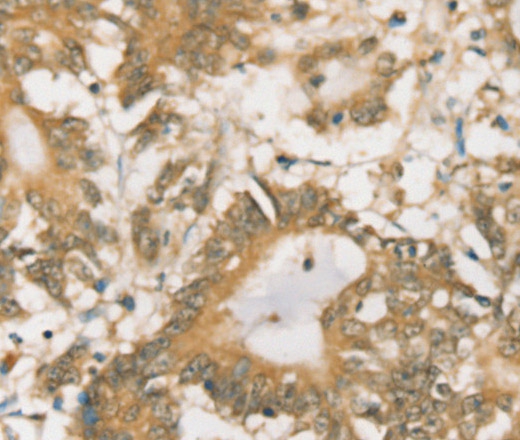 SIGLEC15 Polyclonal Antibody (E-AB-16819)