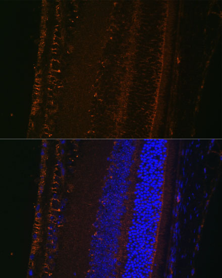 LOXL1 Polyclonal Antibody (E-AB-63293)