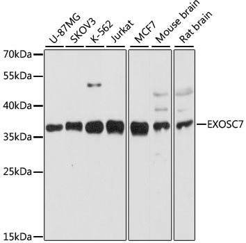 EXOSC7 Polyclonal Antibody (E-AB-68027)