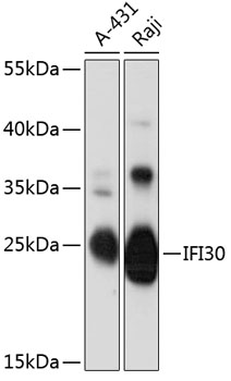 IFI30 Polyclonal Antibody (E-AB-90545)