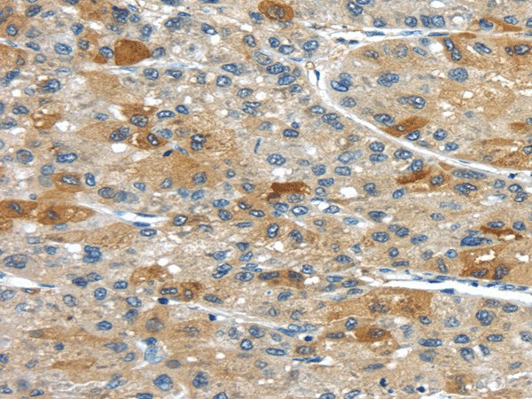 UPP2 Polyclonal Antibody (E-AB-17532)
