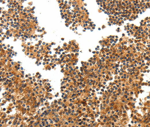 TERT Polyclonal Antibody (E-AB-12901)