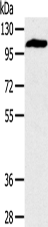 PYGM Polyclonal Antibody (E-AB-15321)