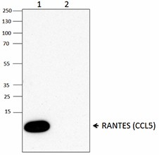 Purified anti-RANTES (CCL5) Antibody (515502)