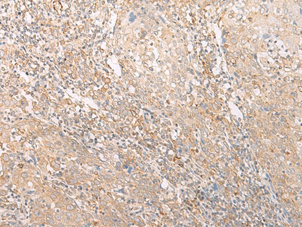 EPS15 Polyclonal Antibody (E-AB-17923)