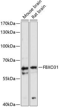FBXO31 Polyclonal Antibody (E-AB-90524)