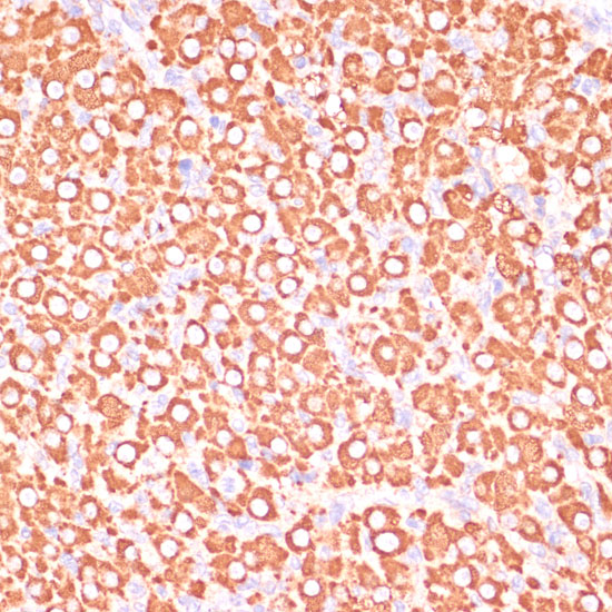 MAP2K3 Polyclonal Antibody (E-AB-67908)