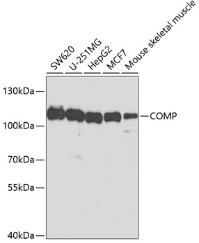 COMP Polyclonal Antibody (E-AB-67707)