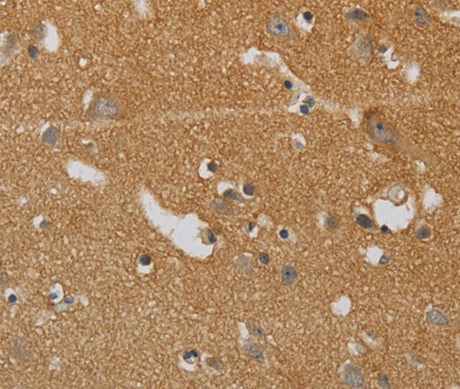 KIF4A Polyclonal Antibody (E-AB-16547)