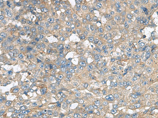 CXCR5 Polyclonal Antibody (E-AB-19280)
