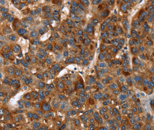 CACNB2 Polyclonal Antibody (E-AB-16294)
