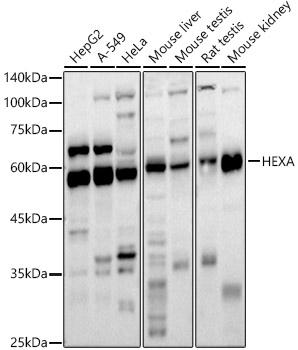 HEXA Polyclonal Antibody (E-AB-92661)