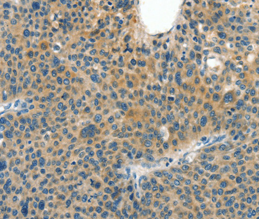 CRLF2 Polyclonal Antibody (E-AB-13161)