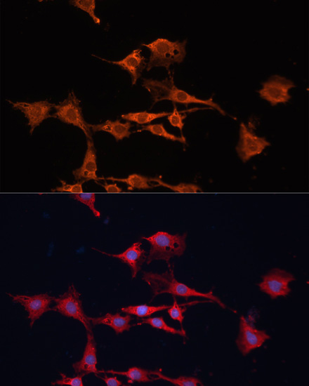 GSTM3 Polyclonal Antibody (E-AB-65555)