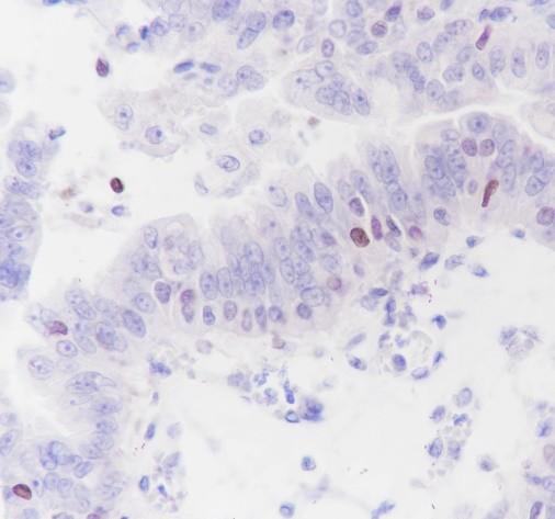 Recombinant SATB1 Monoclonal Antibody (AN301653L)