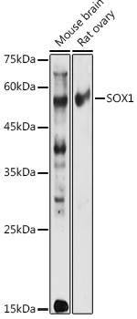 SOX1 Polyclonal Antibody (E-AB-92510)