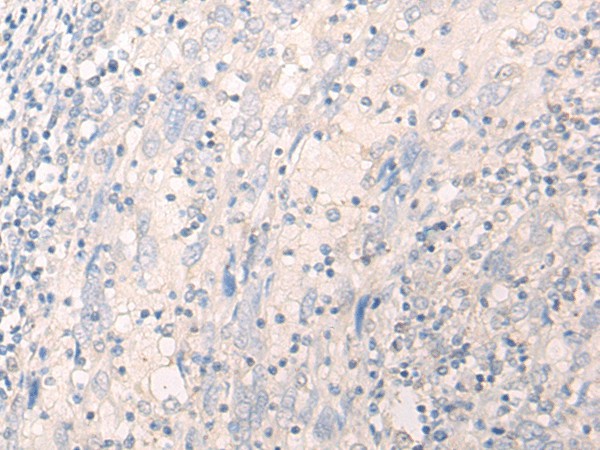 LILRA2 Polyclonal Antibody (E-AB-18728)
