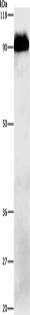 beta Amyloid Polyclonal Antibody (E-AB-15509)