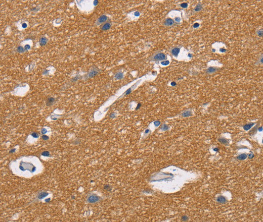 CD47 Polyclonal Antibody (E-AB-16320)
