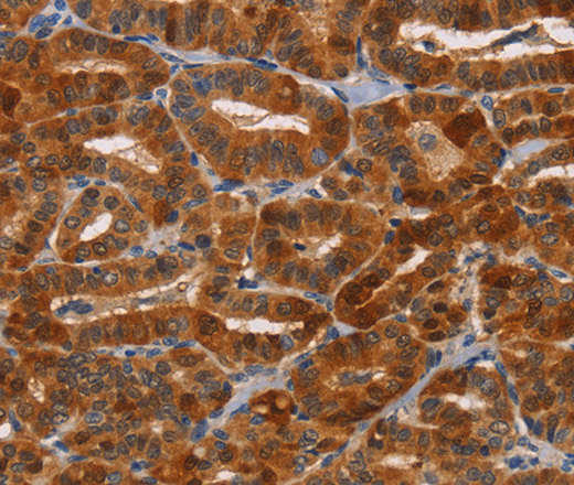 NCR1 Polyclonal Antibody (E-AB-13121)