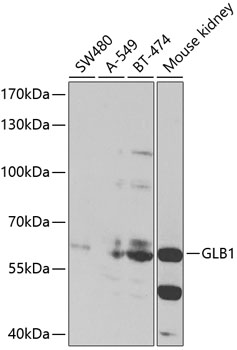 GLB1 Polyclonal Antibody (E-AB-66122)
