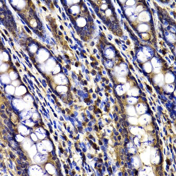 ARID3A Polyclonal Antibody (E-AB-62067)