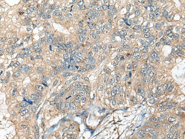 CASR Polyclonal Antibody (E-AB-18582)