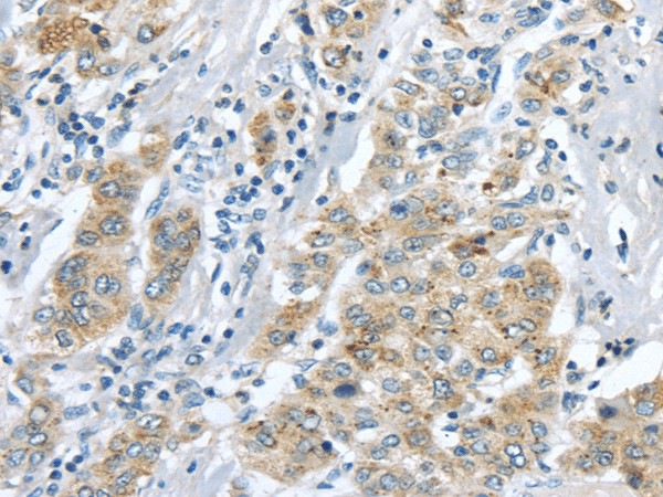 LRP6 Polyclonal Antibody (E-AB-17347)