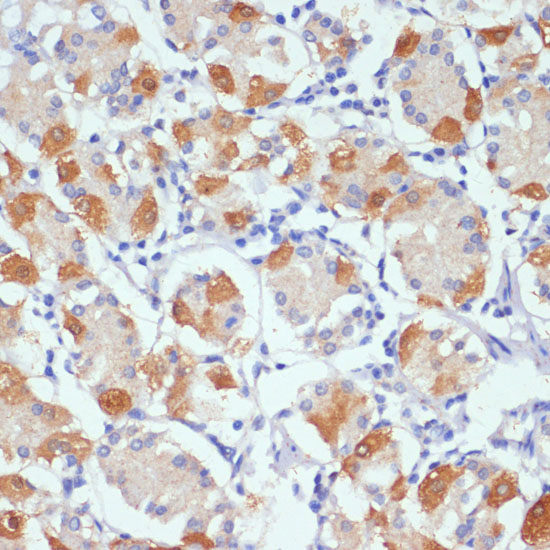 AHR Polyclonal Antibody (E-AB-62004)