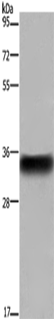 CD32 Polyclonal Antibody (E-AB-15026)
