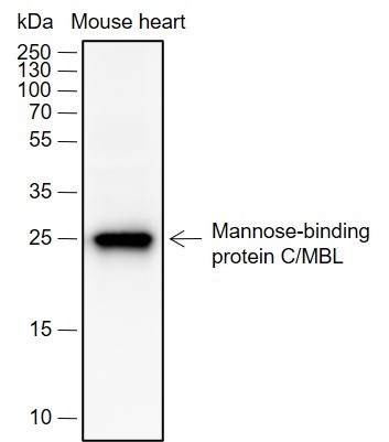 Recombinant MBL2 Monoclonal Antibody (AN301978L)