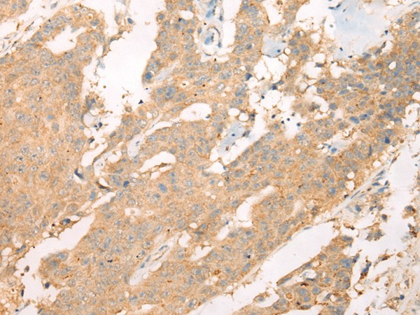 ASIC3 Polyclonal Antibody (E-AB-19330)