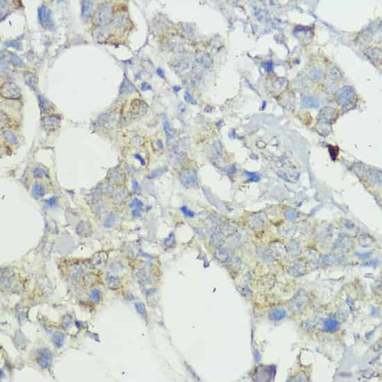 SOCS6 Polyclonal Antibody (E-AB-62303)