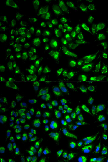 SPAM1 Polyclonal Antibody (E-AB-60620)