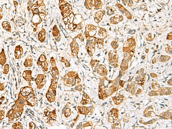 RIMS3 Polyclonal Antibody (E-AB-18818)