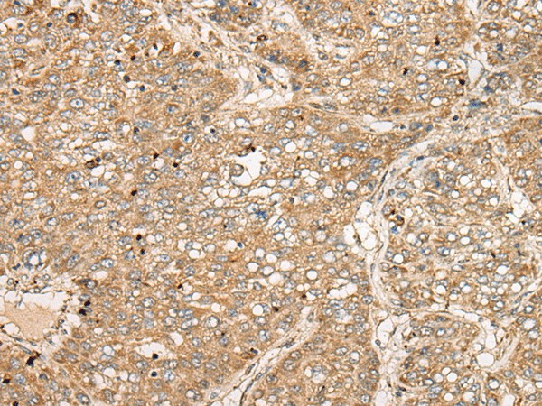 TDGF1 Polyclonal Antibody (E-AB-52405)
