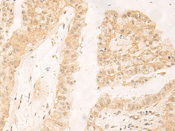 RBX1 Polyclonal Antibody (E-AB-52795)