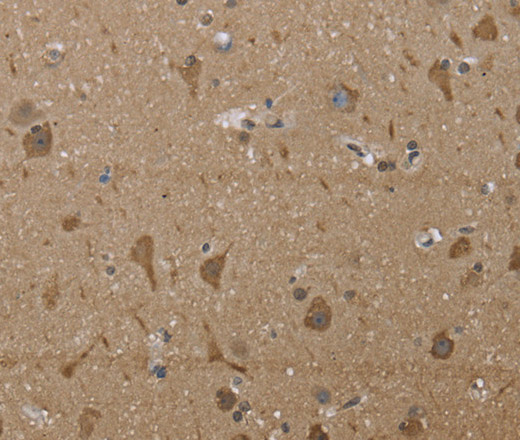 PTK2B Polyclonal Antibody (E-AB-11212)