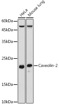 Caveolin-2 Polyclonal Antibody (E-AB-92288)