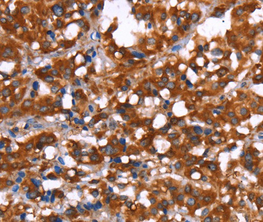 GAGE12I Polyclonal Antibody (E-AB-16448)