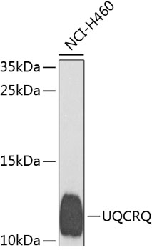 UQCRQ Polyclonal Antibody (E-AB-62420)