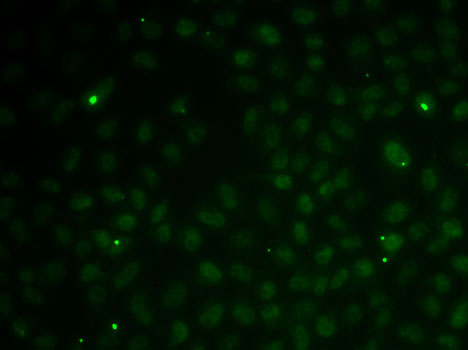 RAD51C Polyclonal Antibody (E-AB-65915)