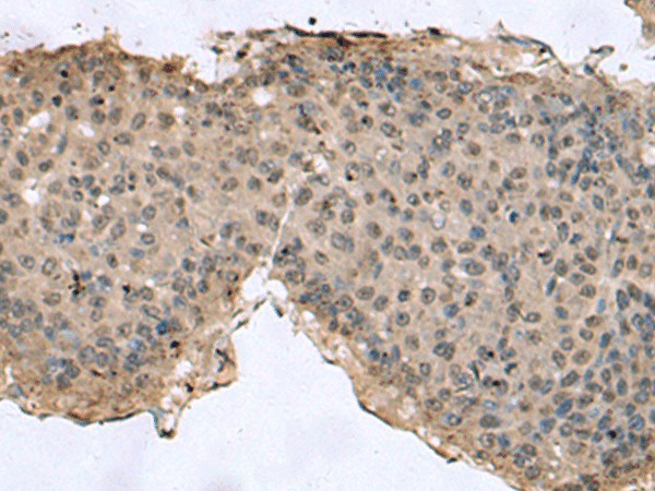 TMX3 Polyclonal Antibody (E-AB-53074)