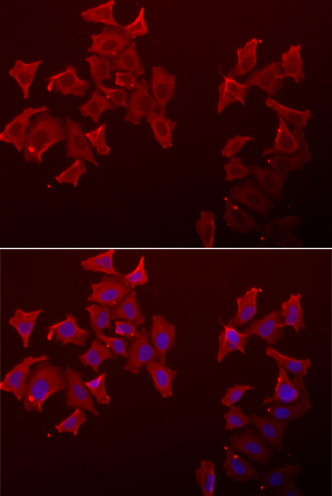LECT1 Polyclonal Antibody (E-AB-61269)