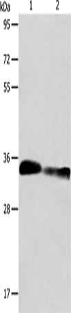 ACY3 Polyclonal Antibody (E-AB-14494)